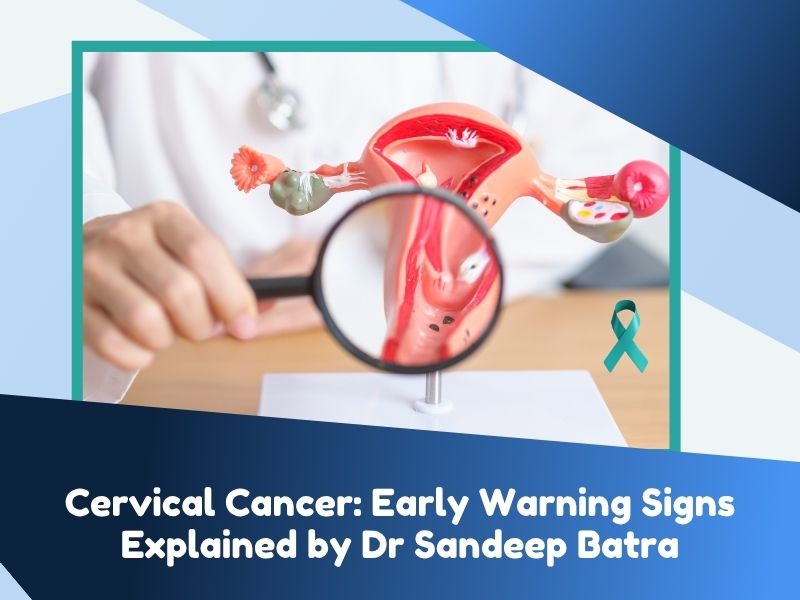 cervical cancer