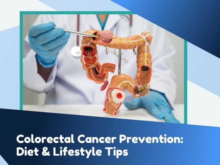 Colorectal Cancer