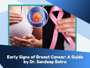 Early Signs of Breast Cancer