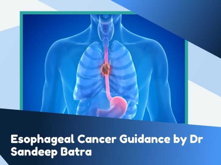 Esophageal Cancer