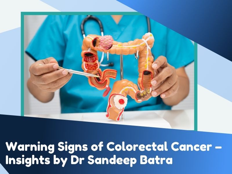 warning signs of colorectal cancer