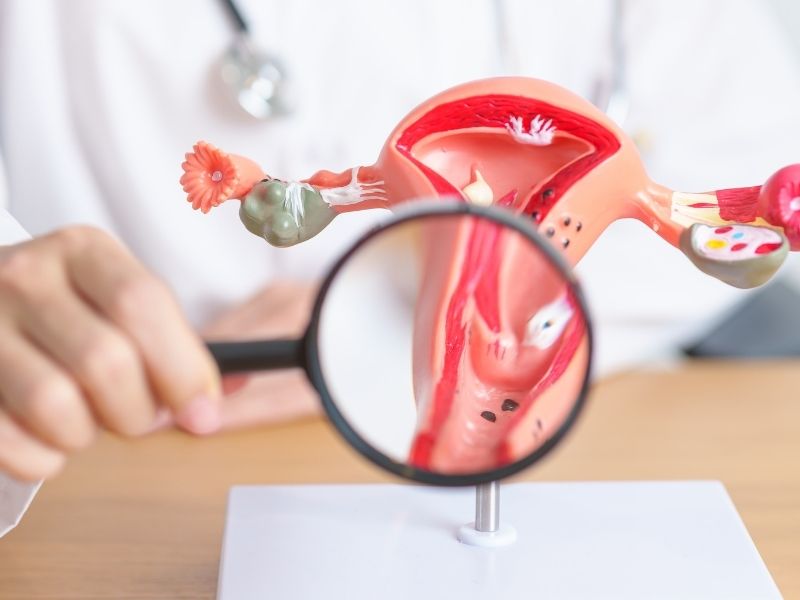 Treatment Options for Cervical Cancer