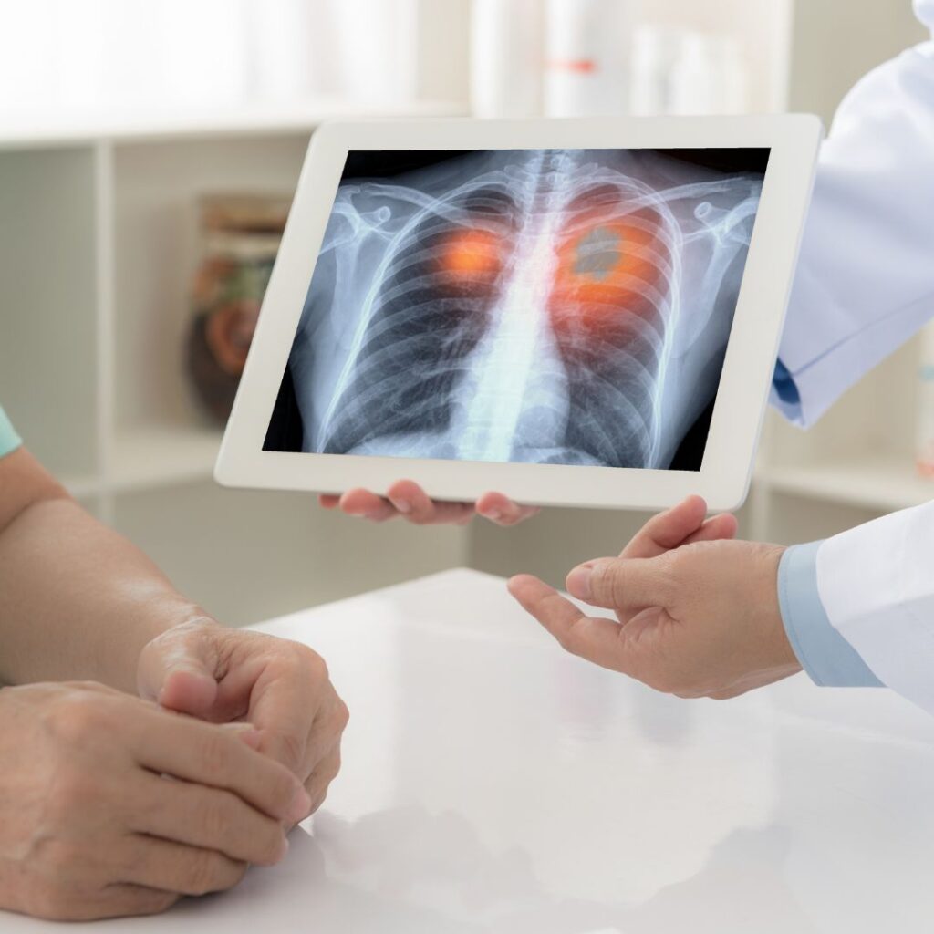 Medical Oncologist in Delhi