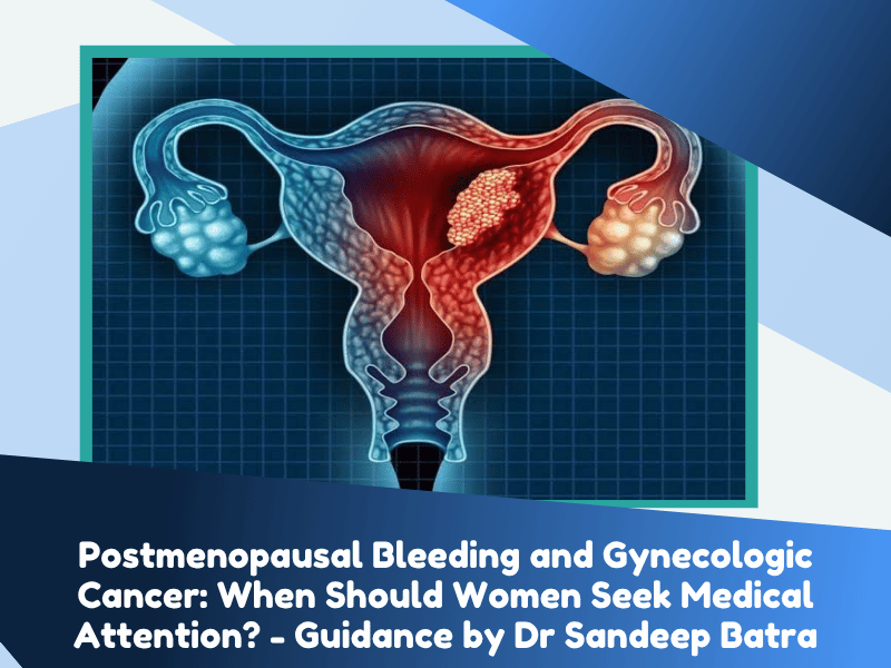 Postmenopausal Bleeding